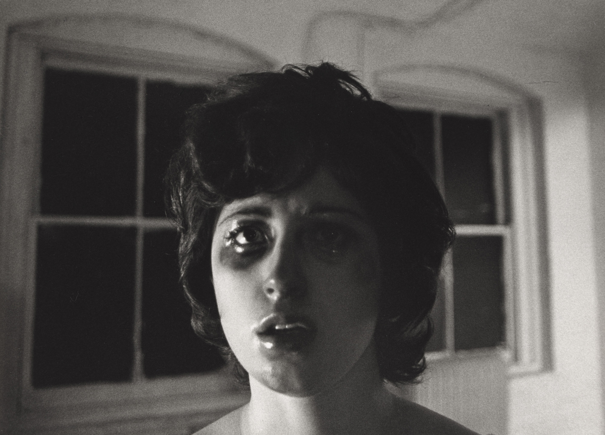 Black and white picture of a woman with dark circles under eyes